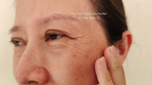 “Woman over 50 examining dark spots on her cheek in natural light.”